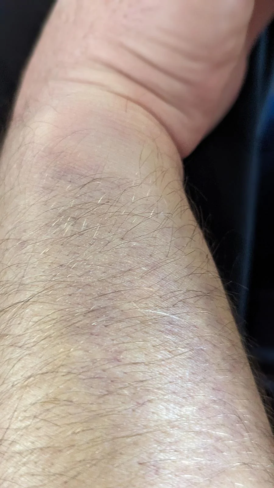 11th Gen Honda Civic PointByPatrol #21985 Build Journal! RIP #9243 PXL_20240325_214329013.PORTRAIT